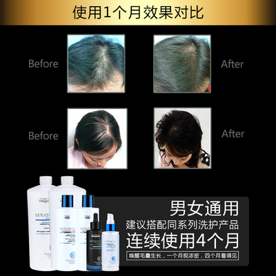 科技賦能防脫，歐萊雅芯基源洗護套裝 深入發(fā)芯，重塑強韌發(fā)絲